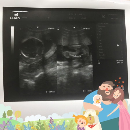 คุณแม่ช่วยดูให้หน่อยนะคะ ว่าน้องเพศอะไร