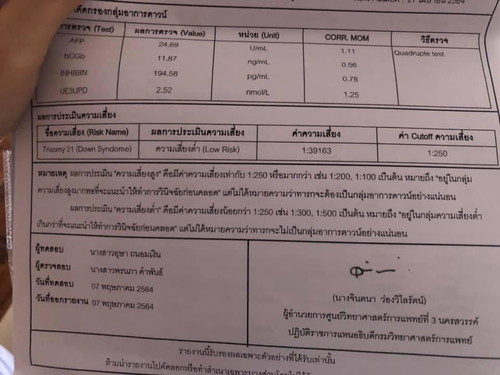 ผลคัดกรองดาวน์ซินโดรม ผลแบบนี้คือดีหรือแย่ค่ะแม่ๆ