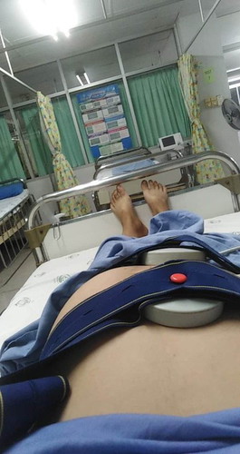 จะคลอดก่อนกำหนด