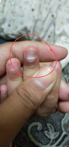 kuku anak sy