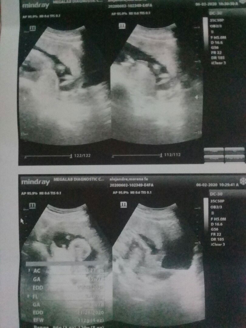 16weeks ultrasound