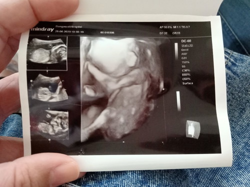 18w2d