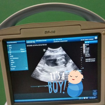 positif thinking ๐ค