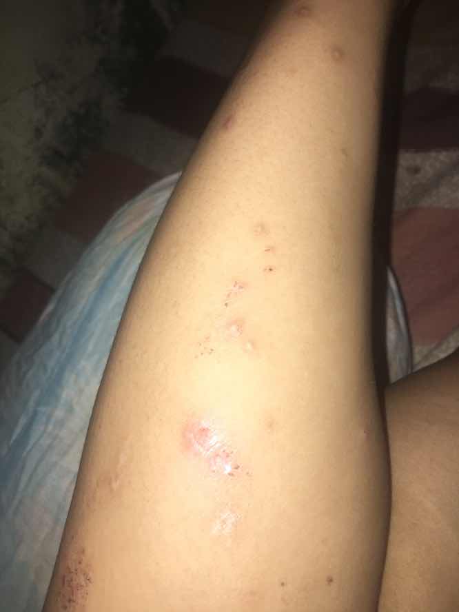 Gatel2 sekujur tubuh saat hamil.