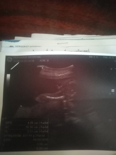 แม่ดูออกมั้ยว่าผู้หญิงรึว่าผู้ชาย