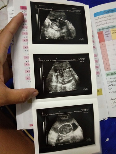 ครั้งแรกกับการซาวตื่นเต้นแต่ปิด?