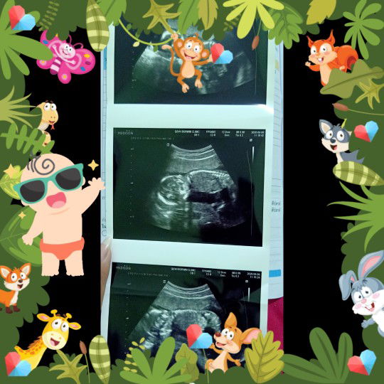 Natthanicha Suandokmai profile icon