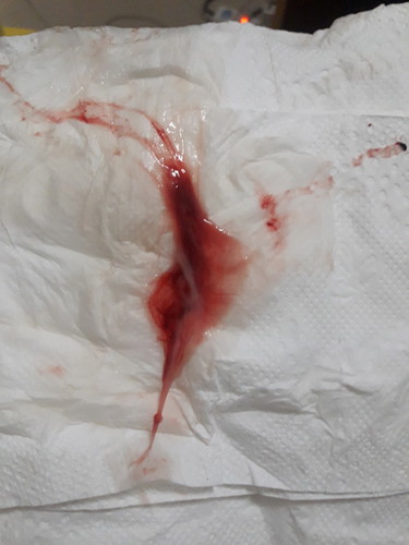 ใกล้แล้วตื่นเต้นจัง 39w+2