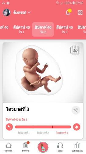 มีอาการปวดท้องจะคลอด 40+2แล้ว