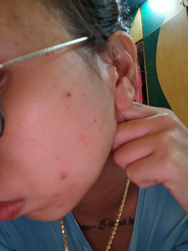 Face Issue