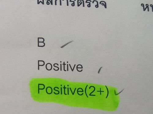 แม่บ้านไหน ตรวจเลือดแล้วพบผลเลือดแฝง Positive(2+)บ้างไหมคะ