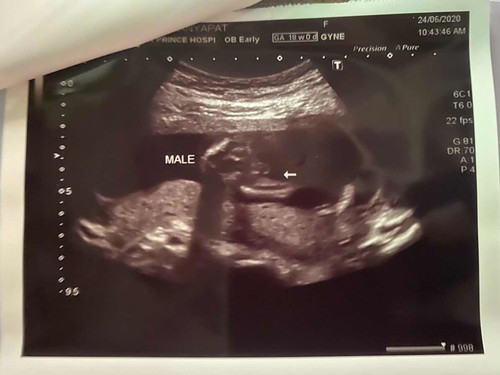 สอบถามจ้า