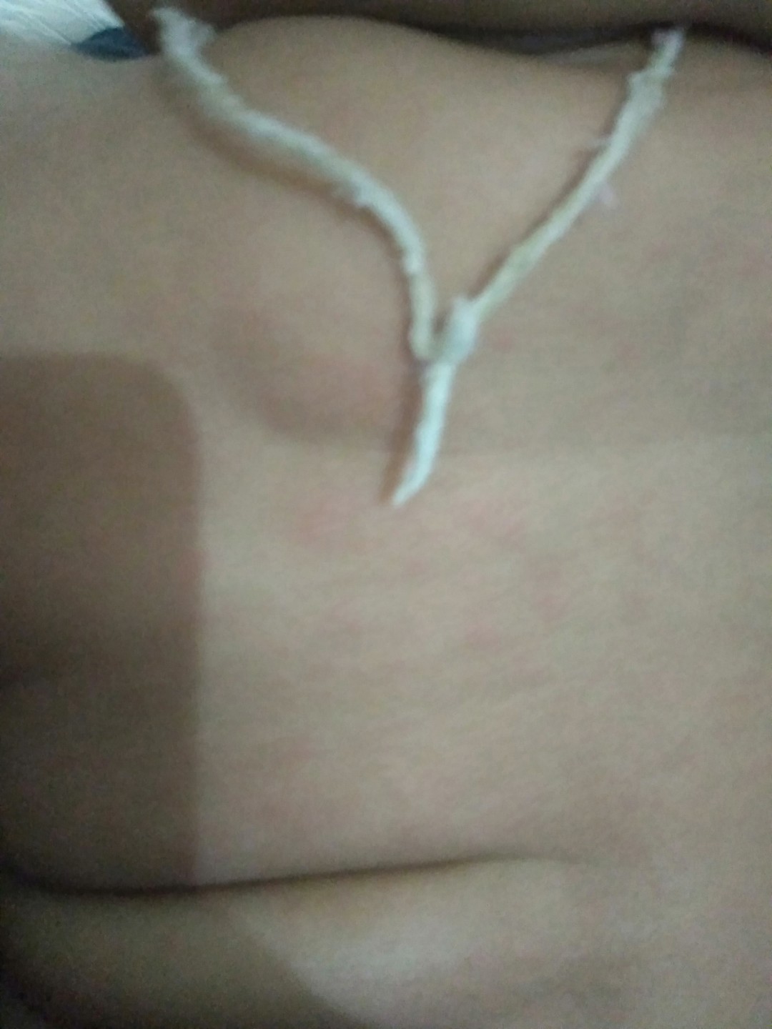Bintik merah di punggung