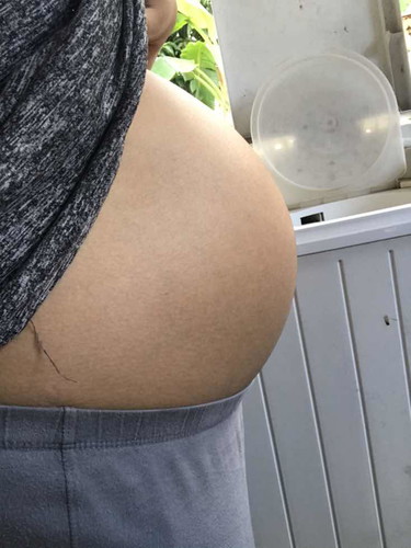 34wไม่มีอาการที่จะเจ็บท้องเตือนเหมือนคนอื่นเลยยย