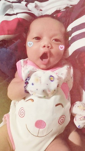 ลูกร้องทุกครั้งเวลาจะถ่ายหรือผายลมคล้ายเจ็บหรือปวด