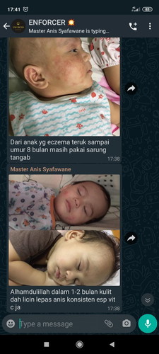 TESTIMONI KENALAN RAPAT SYIKIN SENDIRI CONSUME ESP ,EKZEMA ANAK BERANSUR PULIH 😚
