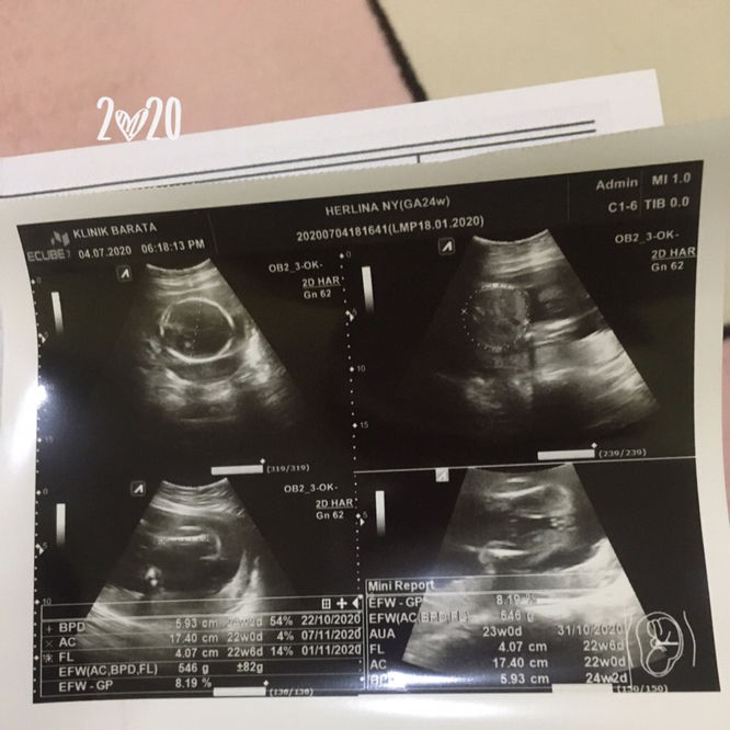 Sedih campur senang juga sih🥺