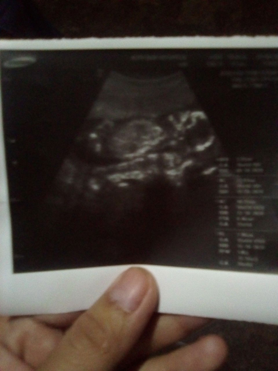 ไอ้ยต้าวความรัก