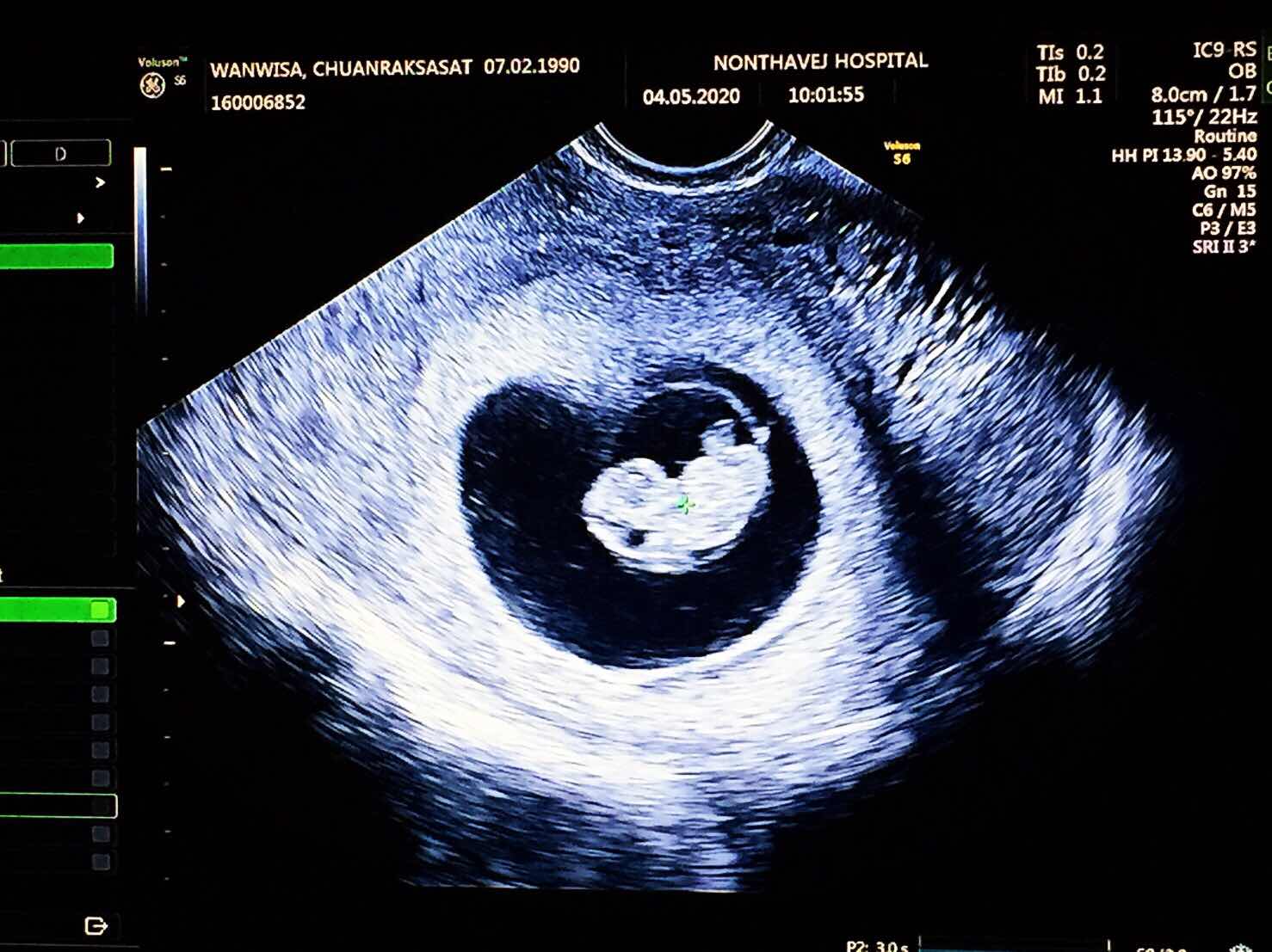 Wanwisa profile icon