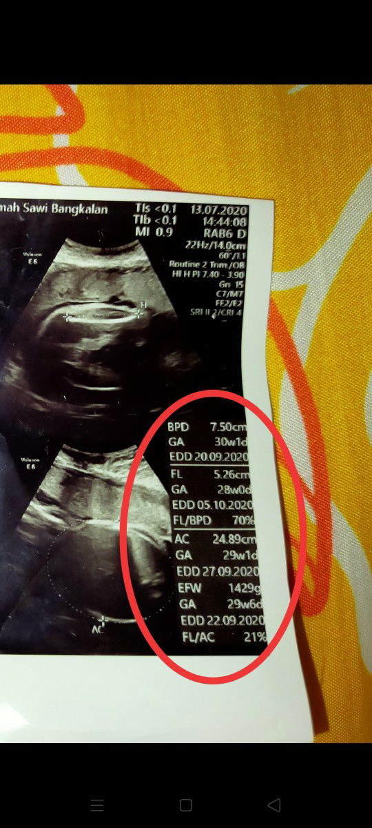 ukuran janin