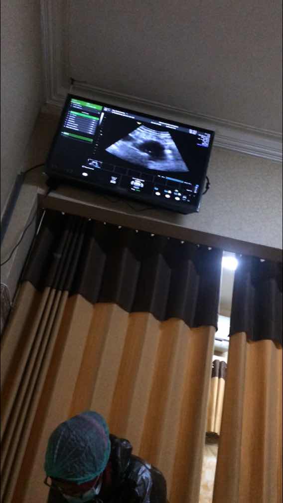 ? minta saran dan doanya bund.. ??