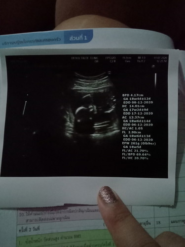 ตกใจ ทำไมลูกถึงไม่ดิ้น