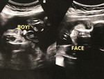 Baby JJ ♥️ profile icon