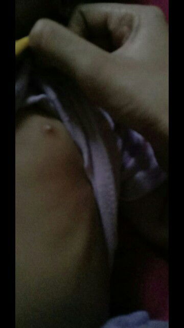 benjolan putih pd payudara anak