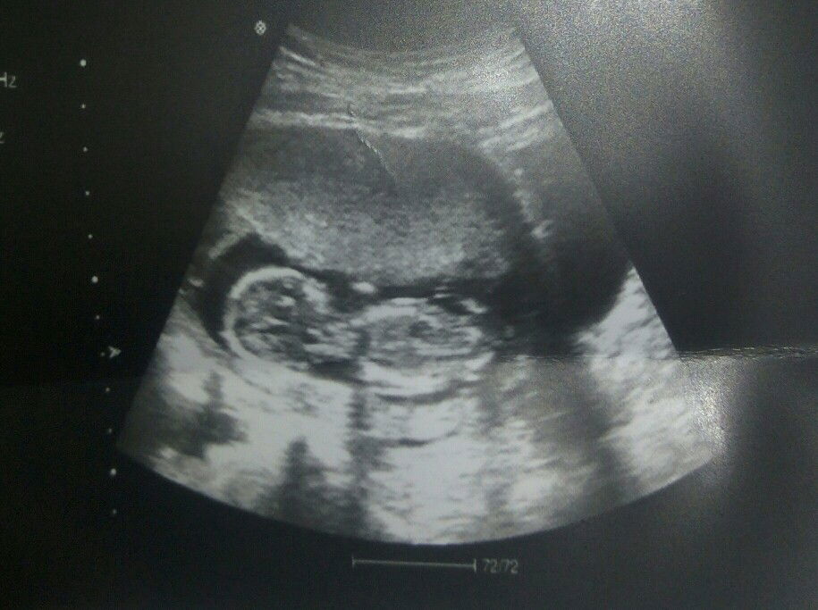 louise adrielle reo profile icon