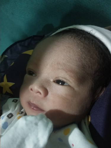 bruntusan d kepala.toolongg solusinya dong bunda anak sy umur 8hari muncul seperti ini.