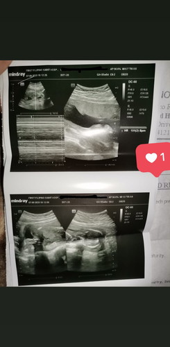 20th Week