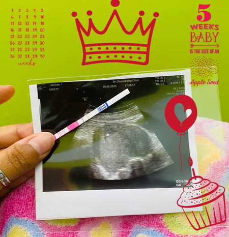 มีแม่ๆๆคนไหน ท้องได้ 5วีนแล้ว มีเลือด ออกบางค่ะ. ตอนนี้ไปหาหมอไม่ได้ติดเคอร์ฟิว