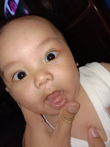 Baby teething.