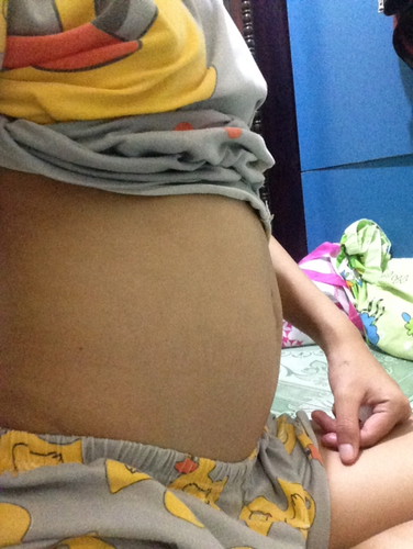 ท้องเล็กไปมั้ยค่ะ