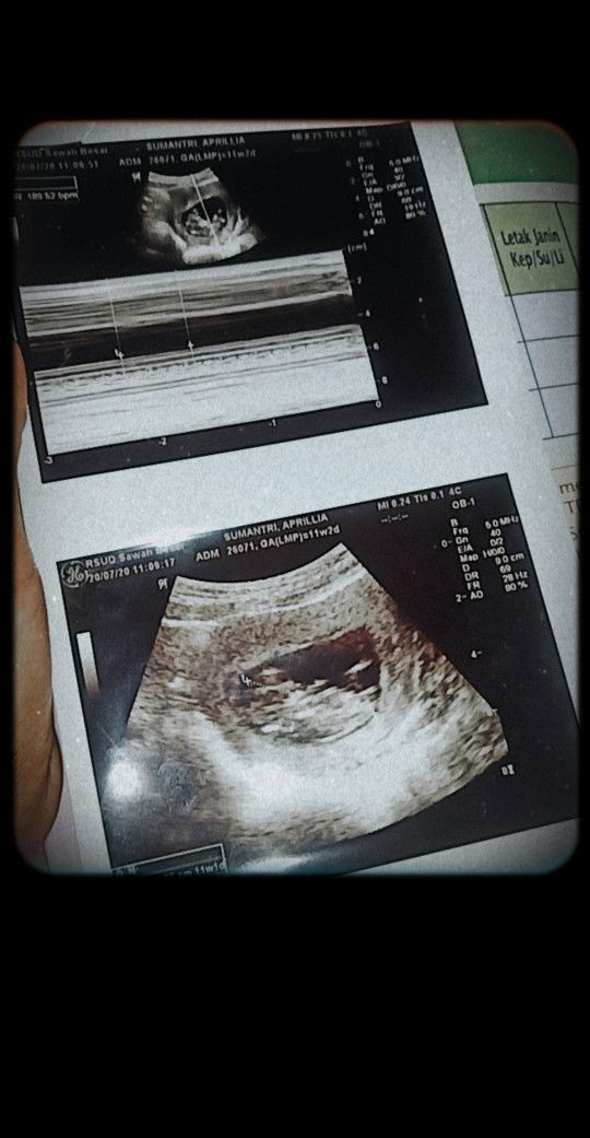 Aprillia profile icon