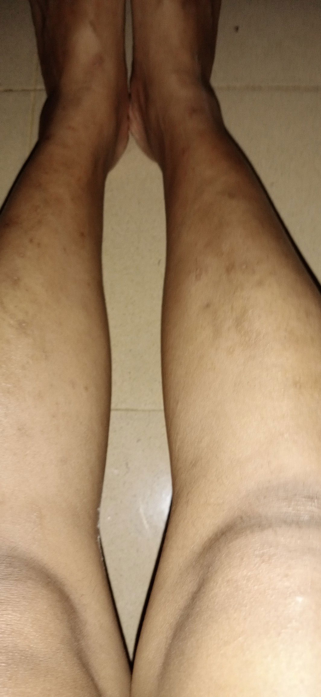 Kaki blentang blentong