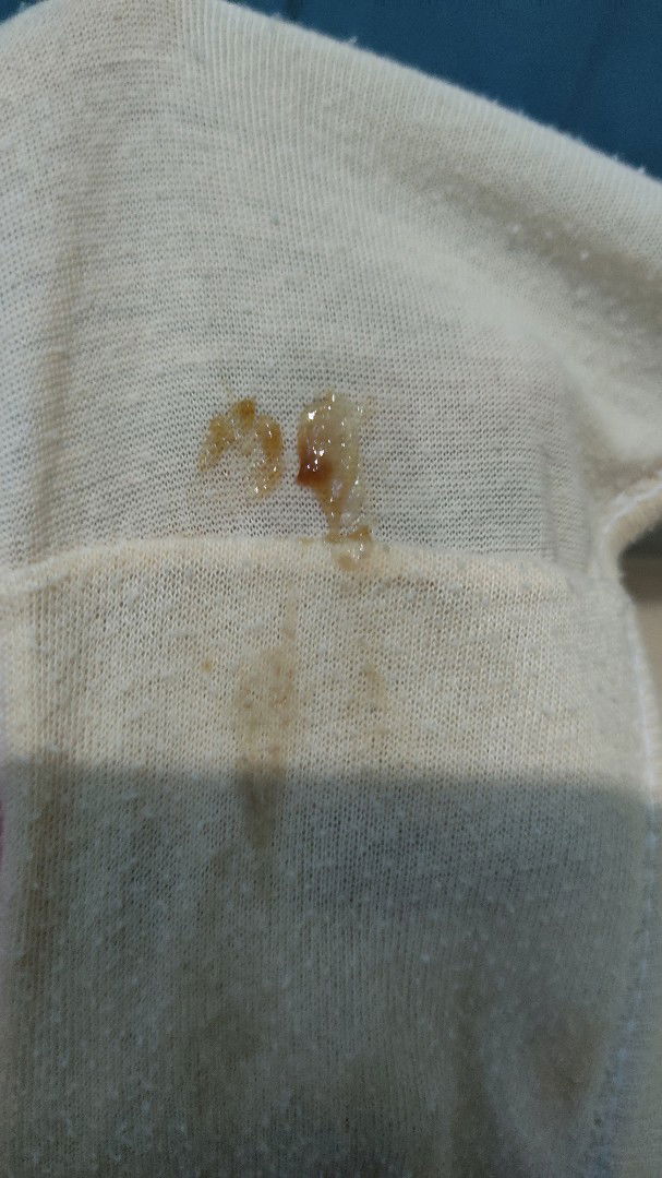 brown discharge 39 weeks and 3 days