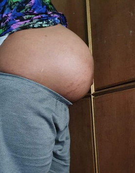 38 weeks and 3 days