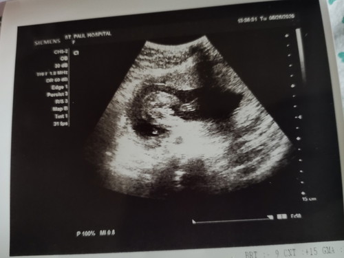 PA NOTICE! ULTRASOUND