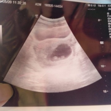 9w3d