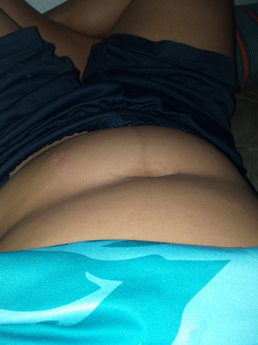 น้องไขมัน