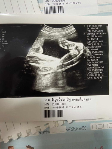 จากภาพเรา อายุครรภ์กี่เดือนแล้ว เรากำลัง งง