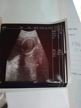 22week6วัน คุณหมอบอกผู้หญิงค่ะ คุณแม่มองไม่ออกเลย