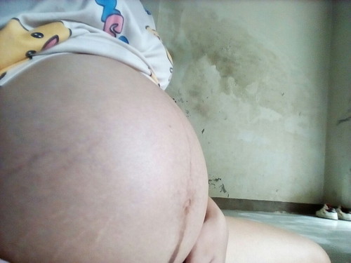 ท้องเล็กไปไหมจ๊ะ33week. แร้วจร้า