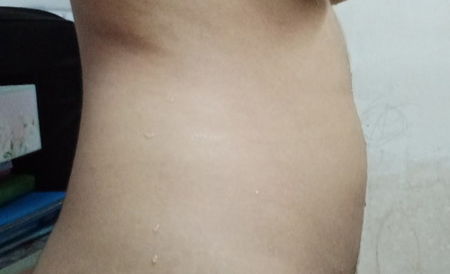 เหมือนคนท้องมั้ยคะ
