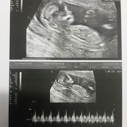 แบบนี้ลุ้นเพศไหนดีน้า