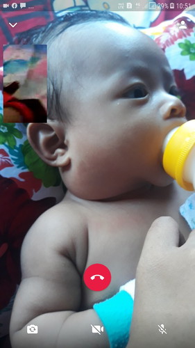 Bayi saya abis demam 2 hari tiba2 lehernya bengkak sampai sekarang, bahaya ngak bun