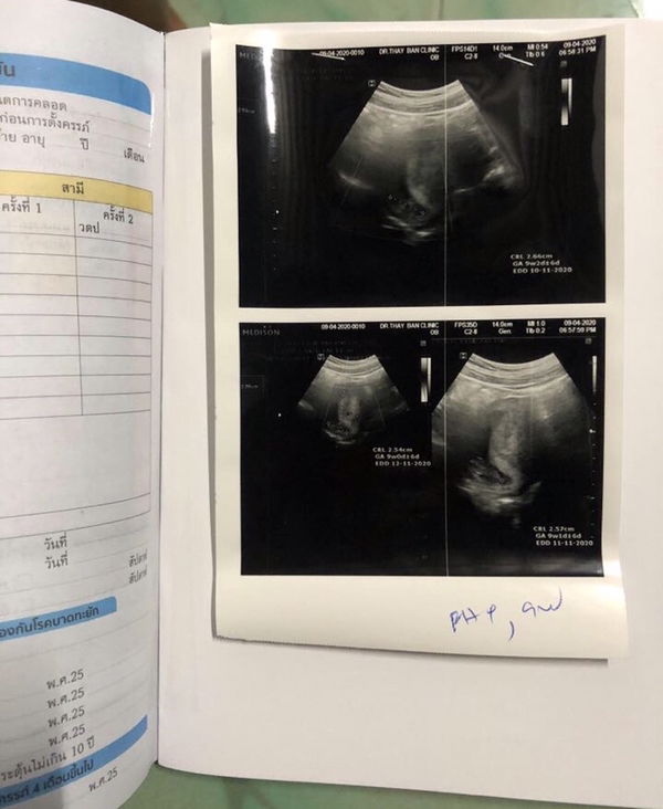 Thakun Bunnathong profile icon