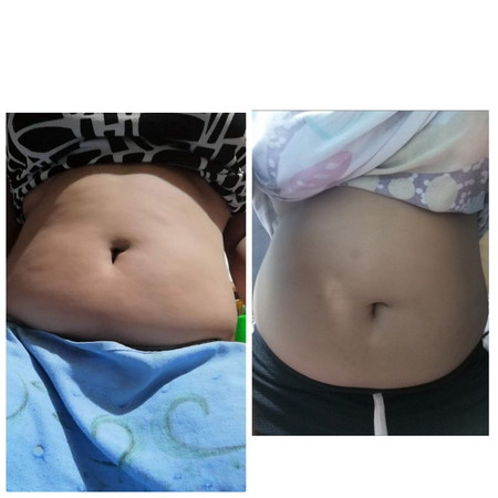 3months Preggy Pero Tingin Ko Wala Naman Nagbago Sa Tummy Ko ?