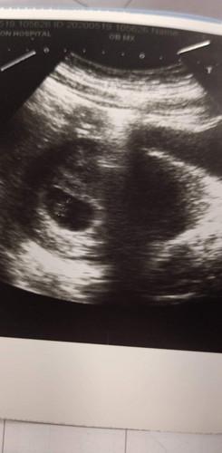 สอบถามจ้า